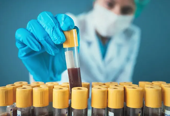 ALT Blood Test High Levels